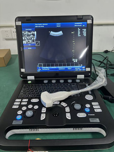 CE Meilleur <span class=keywords><strong>Prix</strong></span> Échographe Portable 3D Couleur Doppler pour Clinique et Hôpital SUN-906A - Product Image 2