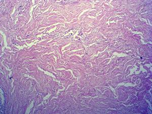 निर्माता मानव पैथोलॉजी अनुभाग स्लाइड 100 मानव स्थानीय सूजन माइक्रोस्कोप उपकरण के टुकड़ों का उत्पादन करते हैं - Product Image 4