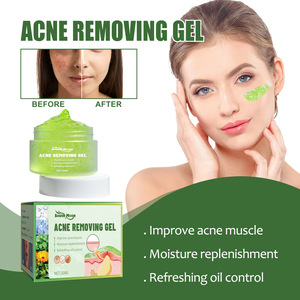 เซาท์มูน แอนตี้-แอคเน่ เฟเชียล เจล ลดรอยสิว ปิดรูขุมขน ทำความสะอาดผิว และปรับสภาพผิวที่มีปัญหา<span class=keywords><strong>สิว</strong></span> 30 มล. - Product Image 4