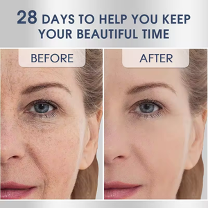 Suero Facial Personalizado con Vitamina C Natural de Día y Noche, Corrector de Manchas Oscuras con Arbutina, Blanqueador, Antiarrugas, Líquido Vegano - Product Image 3