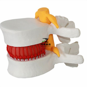 Modelo de Columna Vertebral Interlumbar Humana de Alta Calidad, Modelo Óseo para Enseñanza Médica - Product Image 1
