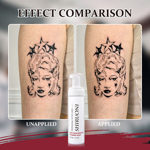 มูสบำรุงหลังการสักฉลากส่วนตัวสำหรับการรักษาและป้องกันช่วยให้ผ่อนคลาย - Product Image 6