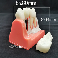 Modèle d'implant dentaire, couronne, pont, modèle amovible, modèle de dents en porcelaine, modèle de démonstration dentaire pour l'enseignement des dentistes