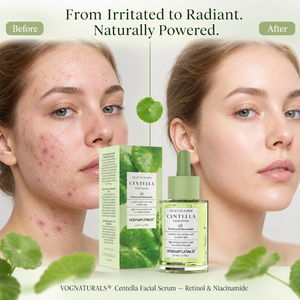 Siero Viso alla Centella Asiatica con Etichetta Privata, Siero Illuminante con Retinolo e Niacinamide, Lenisce e Ripara Pelli Irritate, Sensibili e Soggette ad <span class=keywords><strong>Acne</strong></span> - Product Image 1