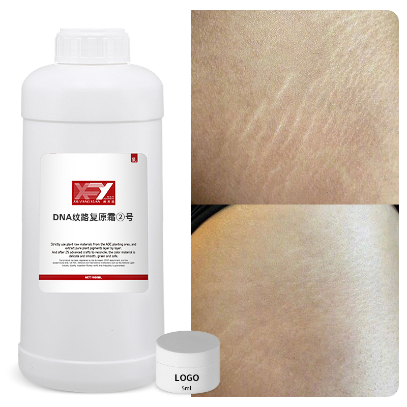 Stretch Marks Cream Repair Stretch Marks