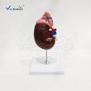 Modelo de Estructura Renal Humana con Glándula Adrenal, Espécimen de PVC para Entrenamiento en Laboratorio de Anatomía, <span class=keywords><strong>Nefrología</strong></span> <span class=keywords><strong>y</strong></span> <span class=keywords><strong>Urología</strong></span>, CE/ISO/ROHS/CNAS - Product Image 5