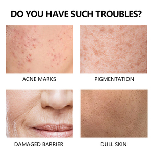 <span class=keywords><strong>Crema</strong></span> Facial de Marca Privada para el Cuidado de la Piel, Antienvejecimiento, Reafirmante e Iluminadora, con Colágeno Natural y Vitamina C en Cápsulas - Product Image 2