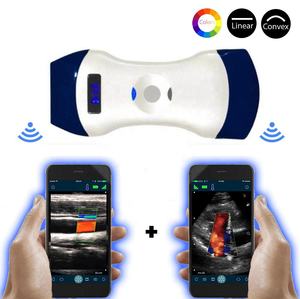 Sonostar Ultrasound 2 In 1 Dubbele Hoofd Kleur <span class=keywords><strong>Doppler</strong></span> Convex & Lineaire Ultrasound Machine Scanner - Product Image 2