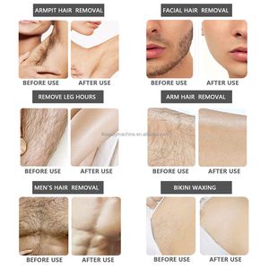 Machine professionnelle de <span class=keywords><strong>cire</strong></span> d'épilation à deux places chauffe-<span class=keywords><strong>cire</strong></span> chaude pour l'épilation efficace du visage des pieds du corps pour le masseur de levage du cou - Product Image 6