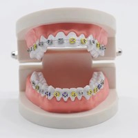 Attaches élastiques orthodontiques dentaires, élastiques colorés pour brackets et appareils dentaires, matériel de traitement orthodontique