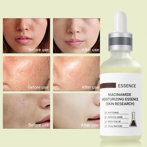 Essence <b>Serum</b> Niacinamide <b>Serum</b> <b>Face</b> Vibrant Glamour Hyaluronic Acid Facial Moisturizer Female Anti Aging <b>Serum</b> - Product Image 4