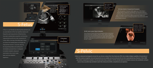 <span class=keywords><strong>Sonoscape</strong></span> P Serie P9/P10/P15/P20/P40/P50/P60 Trolley Kleur Doppler Systeem Echografie Machine - Product Image 4