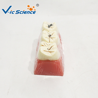 Modelo de Caries Dental de 3 Etapas, Ampliado 5 Veces, Dientes Desmontables para Educación en Patología Oral, CE ISO ROHS CNAS
