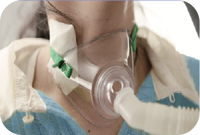 Appareil d'insufflation-exsufflation mécanique (MI-E) – Machine d'assistance à la toux MIE – Système non invasif d'élimination des expectorations