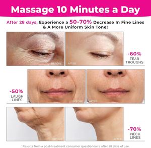 Vẻ đẹp ODM chống lão hóa khuôn mặt và cổ nâng Massager chăm sóc da loại bỏ nếp nhăn với EMS kỹ thuật Da Thắt chặt thiết bị - Product Image 6