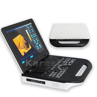 Karestar Échographe numérique portable le moins cher, échographe portable à prix réduit, ordinateur portable, échographe vétérinaire 3D