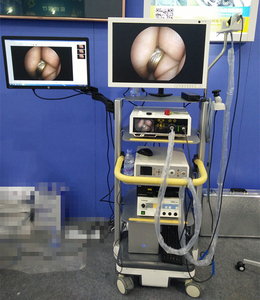 Câmera rígida cirúrgica da endoscopia 1080P para laparoscopia/urologia - Product Image 4