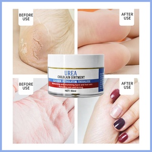 OEM Private Label Urea Chilblain unguento <span class=keywords><strong>crema</strong></span> <span class=keywords><strong>per</strong></span> i <span class=keywords><strong>piedi</strong></span> <span class=keywords><strong>piedi</strong></span> idratante nutrizione ammorbidire Cutin Anti-cracking <span class=keywords><strong>crema</strong></span> <span class=keywords><strong>per</strong></span> i <span class=keywords><strong>piedi</strong></span> e le mani - Product Image 5