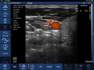 DMU86 カラー ドップラー ワイヤレス プローブ ハンドヘルド ワイヤレス 超音波スキャナー リニアプローブ 最安値 - Product Image 5