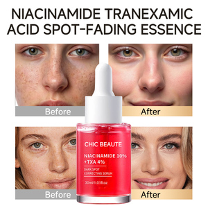 <span class=keywords><strong>CHIC</strong></span> BEATUE Stock Niacinamida 10% Sérum Químico Corrector de Manchas Oscuras, Blanqueador y Antiarrugas, Reduce las Arrugas y Minimiza los Poros - Product Image 5