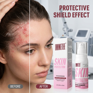 Spray protecteur cutané Immetee 100 ml pour la pose de perruques, protection du cuir chevelu, prévient les irritations de la colle avec Aloe Vera et Hamamélis, OEM - Product Image 2