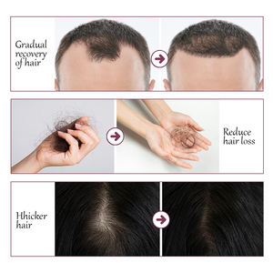 Cabelo COM de Original cuidados O conjunto xampu hortela de alegrim - Product Image 3