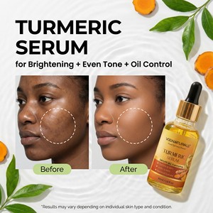 Sérum Visage Hydratant Nuit au Curcuma Éclaircissant Anti-Taches Noires Marque Privée pour les Taches Brunes - Product Image 4