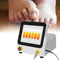 Laser d'élimination des champignons des ongles 980nm laser d'orteils laser de podiarité verrues plantaires