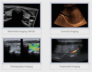 Ecógrafo Veterinario Portátil Dawei Ultrasound DW-P60, Doppler Color, Elastografía, Flujo Sanguíneo, Fabricado en Fábrica con Control Estricto de Calidad - Product Image 5
