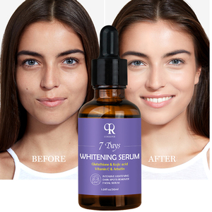 Venta caliente refinación Natural vitamina C niacinamida aligeramiento edad Anti brillo blanqueamiento cara cuidado de la piel suero - Product Image 1
