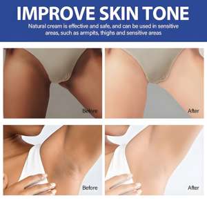 <span class=keywords><strong>Crème</strong></span> <span class=keywords><strong>éclaircissante</strong></span> <span class=keywords><strong>intime</strong></span> à marque privée pour le maillot de bain, les aisselles et les genoux, ODM OEM, avec Niacinamide et Vitamine C - Product Image 6