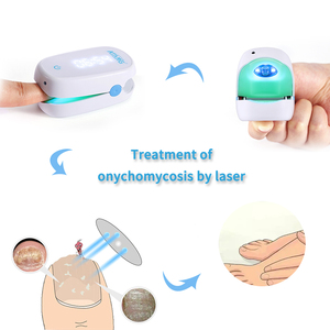 Appareil laser <span class=keywords><strong>antifongique</strong></span> domestique à lumière bleue, irradiation laser 905 nm, lumière bleue 470 nm pour les mycoses récurrentes des ongles et les ongles gris - Product Image 4