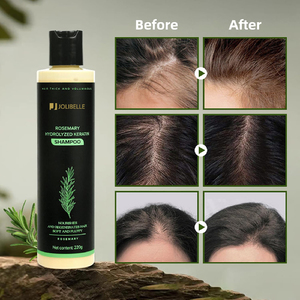 Shampooing Croissance Capillaire au Romarin pour Femmes et Hommes, Shampooing Naturel Épaississant et Fortifiant avec Kératine Hydrolysée pour Cheveux Affinés - Product Image 3