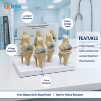 Modèle d'articulation du genou en science médicale, ensemble d'arthrose à 4 étapes, articulation du genou pour le bureau des médecins, outil éducatif