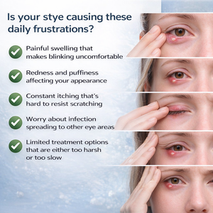 Sérum pour les <span class=keywords><strong>yeux</strong></span> Stye, acide hyaluronique, traitement anti-âge apaisant pour les <span class=keywords><strong>yeux</strong></span>, soulagement des rougeurs <span class=keywords><strong>et</strong></span> des irritations, soin doux pour les <span class=keywords><strong>yeux</strong></span> sensibles - Product Image 3