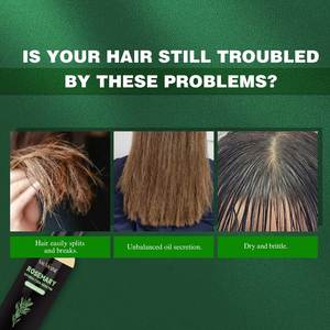 Hydralyzeo cheratina <span class=keywords><strong>Shampoo</strong></span> idratante profondamente nutriente <span class=keywords><strong>per</strong></span> tutti i tipi di capelli scalpo amichevole migliora la forza dei capelli - Product Image 3