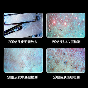 Analizador de Folículos Capilares de Escritorio con Pantalla HD de 10.1 Pulgadas, Aumento de 200x, Detección UV/Fluorescente, Uso Doméstico - Product Image 4