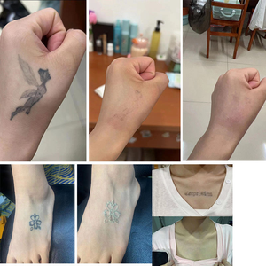 Machine d'épilation au laser à diode de glace 755 808 1064nm en promotion - Product Image 5