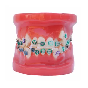 De gros faux dents gomme-Modèle de pratique orthodontique, pour enfant, fausse dent en plastique, avec supports métalliques