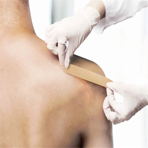 Feuilles de cicatrice en <span class=keywords><strong>silicone</strong></span> médical <span class=keywords><strong>Cicatrices</strong></span> de cicatrice Suppression de produits Produit Cicatrice Supprimer sur mesure - Product Image 2