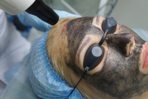 Xách tay ND: Yag Diode Laser tóc và loại bỏ hình xăm máy với da thắt chặt và 1064nm bước sóng cho UK Cắm - Product Image 5