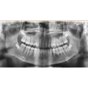 Appareil d'imagerie <span class=keywords><strong>panoramique</strong></span> et céphalométrique à une touche pour une sortie d'images rapide, équipement d'imagerie spécialisé pour les cliniques dentaires - Product Image 5