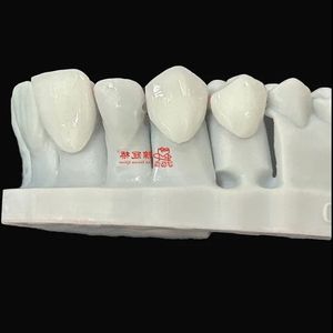 Lapisan porselen yang sangat indah dibuat dengan pengecoran dengan kekuatan tinggi dan terlihat alami dari China <span class=keywords><strong>Dental</strong></span> Lab - Product Image 5