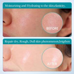 SADOER Usine Grenade Myrtille Carotte Racine Tige Miel Pêche Acide Hyaluronique Masque Facial Soins Du Visage Produits De Beauté - Product Image 4