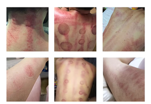 Appareil professionnel 4-en-1 CAVI 40k pour le corps et le visage : aspiration, radiofréquence, amincissement, soin de la peau, usage domestique, spa personnel, raffermissement et ventouses - Product Image 6
