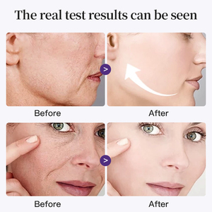 Crème hydratante pour le visage à la vitamine A, au collagène et au rétinol <span class=keywords><strong>ProXylane</strong></span>, marque privée, anti-âge, anti-rides, raffermissante, crème pour le visage - Product Image 6