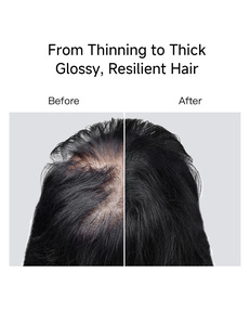 Shampoo liquide concentré rafraîchissant anti-chute de cheveux (formule pour populations spécifiques) lissant, bloquant la <span class=keywords><strong>DHT</strong></span>, stoppe la chute des cheveux - Product Image 6