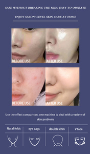 <span class=keywords><strong>TOP</strong></span> <span class=keywords><strong>TECHNOLOGY</strong></span>ハイテク痛みのない、若いコラーゲン豊富な肌になるHello Face Repairingアンチエイジング - Product Image 6