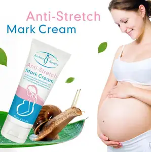 Стрейч-метка крем для отбеливания кожи улитки для удаления шрам и Удаления растяжек крем для беременных женщин