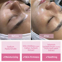Ampoule réparatrice raffermissante hydratante pour la peau, sérum pour le visage, éclaircissant, anti-âge, anti-rides, soin de la peau, ampoules de culture de cellules souches aquatiques